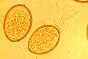 Яйца Fasciola hepatica