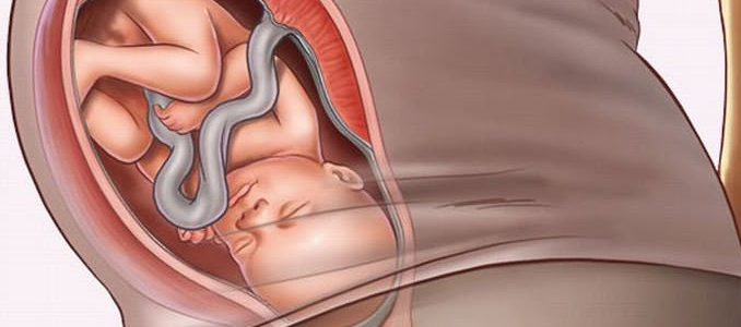 Из-за чего возникает апноэ у новорожденных: причины остановки дыхания