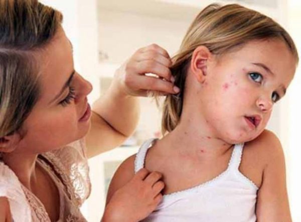 Детские кожные заболевания: симптомы и причины появления