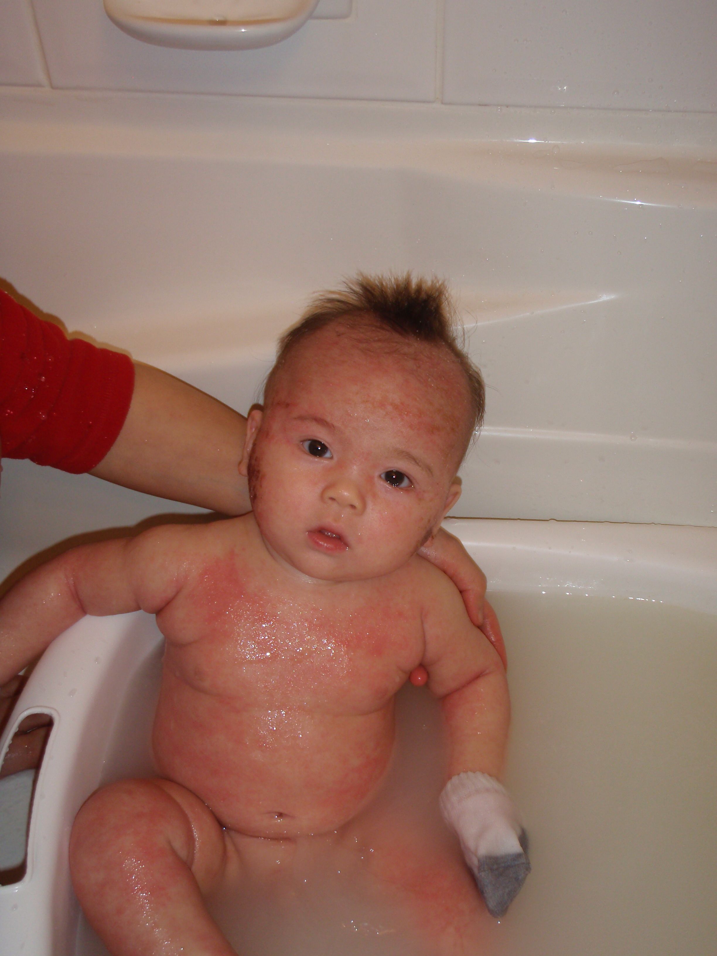 Дети подмываются. Атопический дерматит у новорожденного. Атопический дерматит у грудничка. Атопическийднрмптит у ребенка.