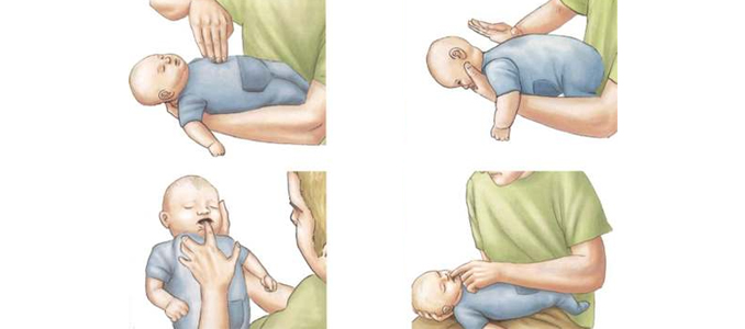 Из-за чего возникает апноэ у новорожденных: причины остановки дыхания
