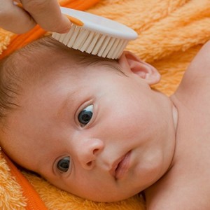 Себорея у детей на голове: признаки, лечение, фото
